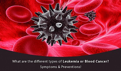What are the different types of Leukemia or Blood Cancer? Symptoms & Preventions!